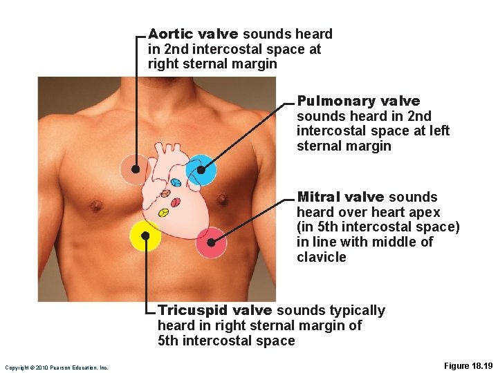 Aortic valve sounds heard in 2 nd intercostal space at right sternal margin Pulmonary