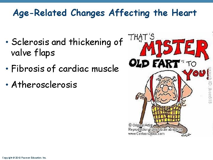Age-Related Changes Affecting the Heart • Sclerosis and thickening of valve flaps • Fibrosis