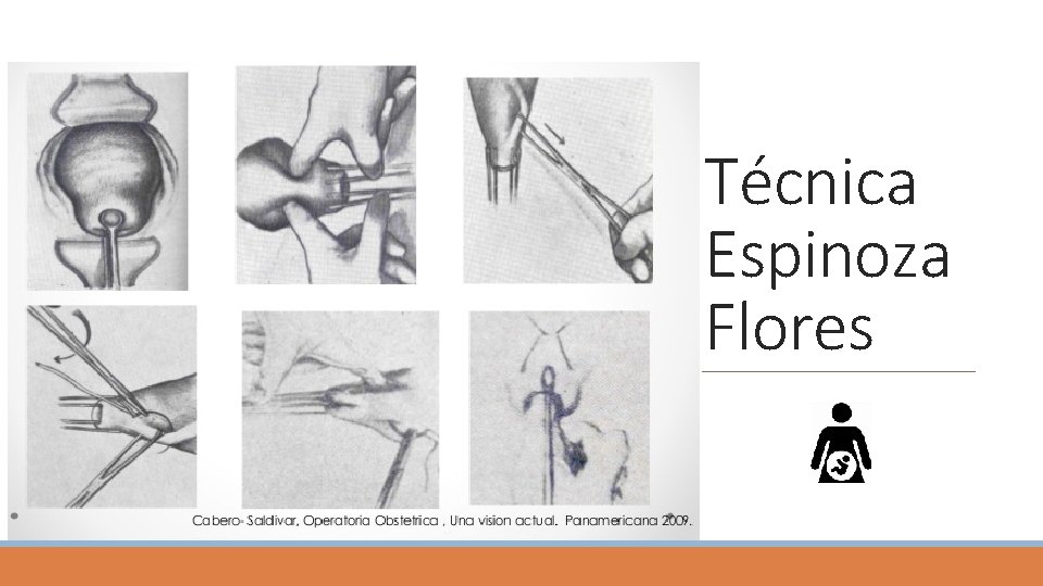 Técnica Espinoza Flores Técnica Espinoza Flores