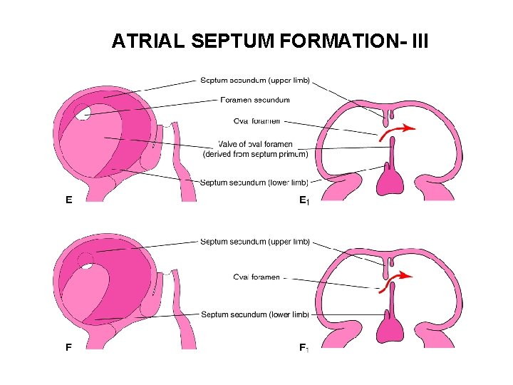 ATRIAL SEPTUM FORMATION- III 