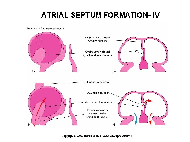 ATRIAL SEPTUM FORMATION- IV 