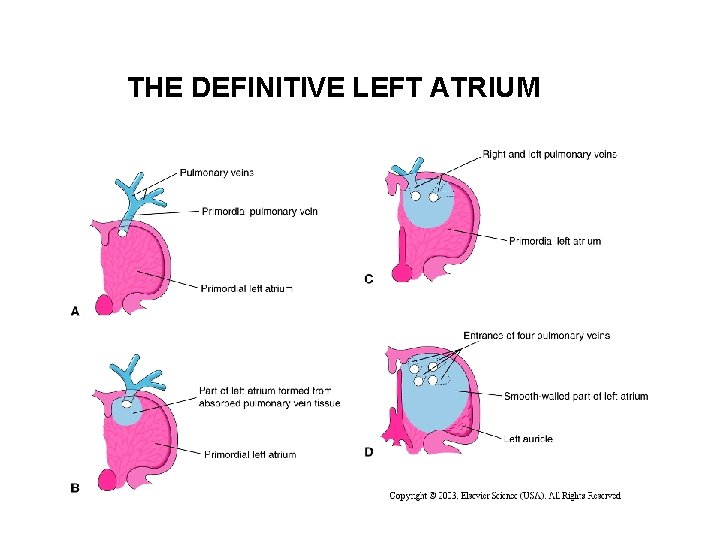 THE DEFINITIVE LEFT ATRIUM 