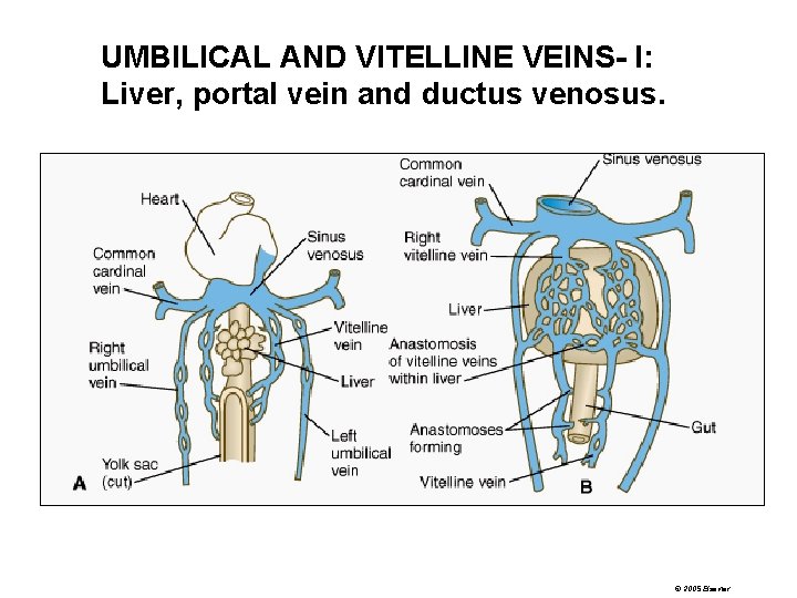 UMBILICAL AND VITELLINE VEINS- I: Liver, portal vein and ductus venosus. © 2005 Elsevier