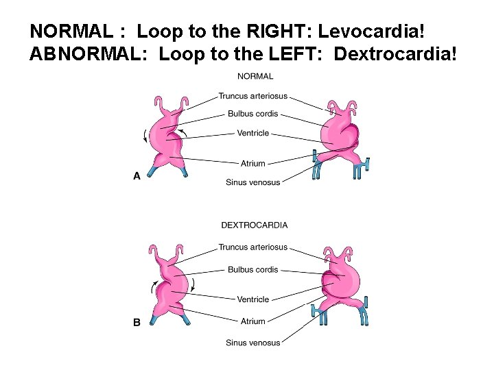 NORMAL : Loop to the RIGHT: Levocardia! ABNORMAL: Loop to the LEFT: Dextrocardia! 