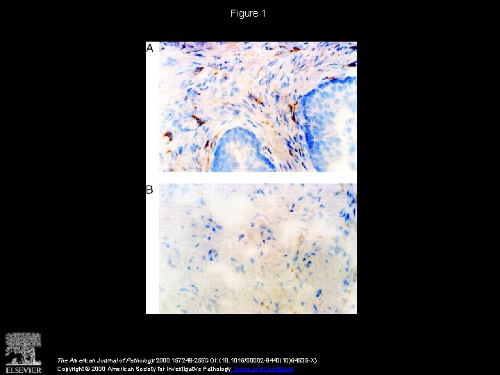 Figure 1 The American Journal of Pathology 2000 157249 -255 DOI: (10. 1016/S 0002