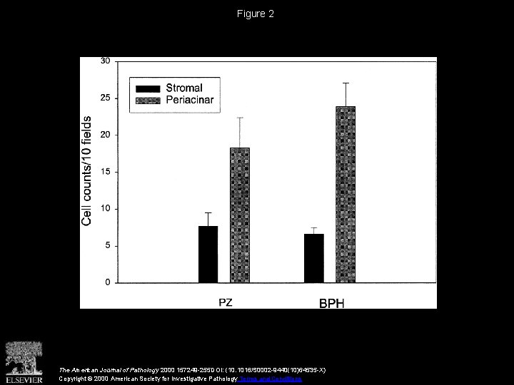 Figure 2 The American Journal of Pathology 2000 157249 -255 DOI: (10. 1016/S 0002