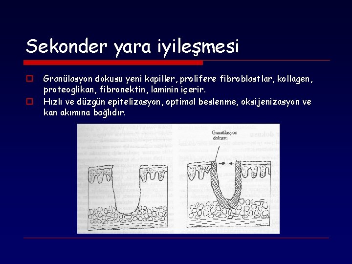 Sekonder yara iyileşmesi o o Granülasyon dokusu yeni kapiller, prolifere fibroblastlar, kollagen, proteoglikan, fibronektin,