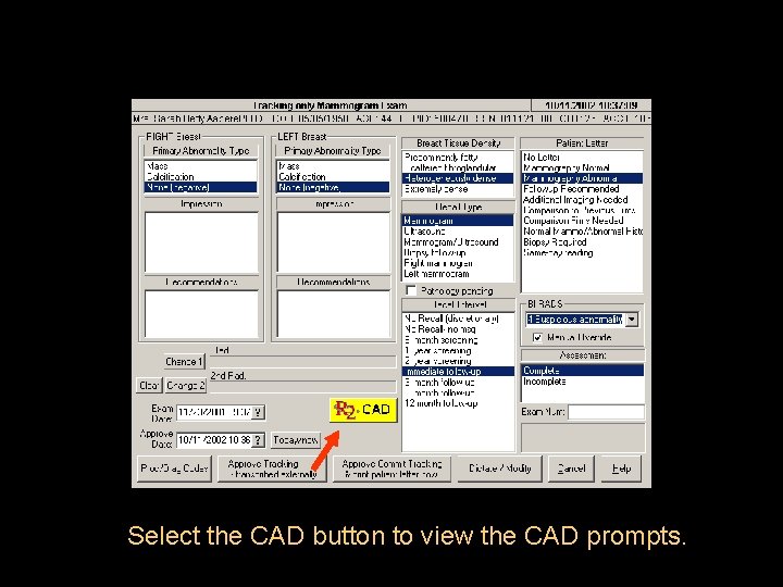 Select the CAD button to view the CAD prompts. 