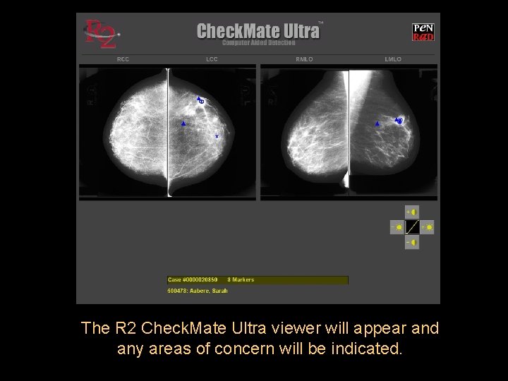 The R 2 Check. Mate Ultra viewer will appear and any areas of concern