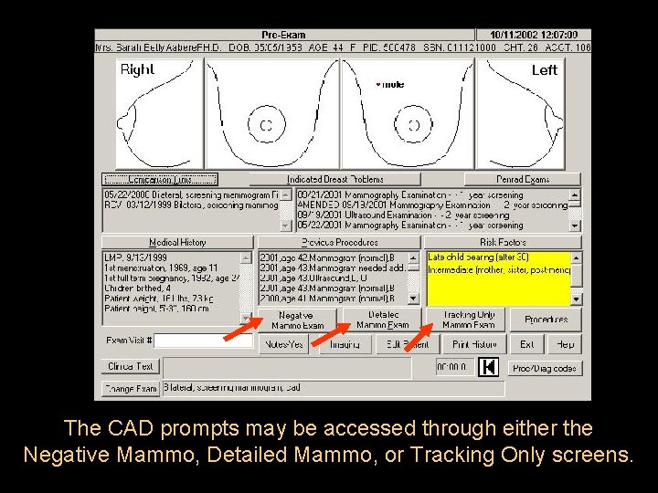 The CAD prompts may be accessed through either the Negative Mammo, Detailed Mammo, or