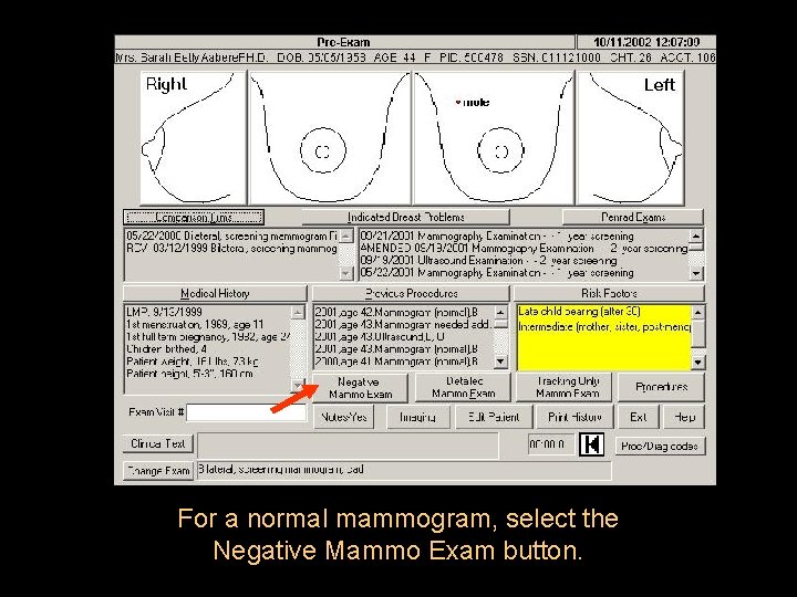 For a normal mammogram, select the Negative Mammo Exam button. 