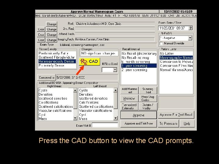 Press the CAD button to view the CAD prompts. 