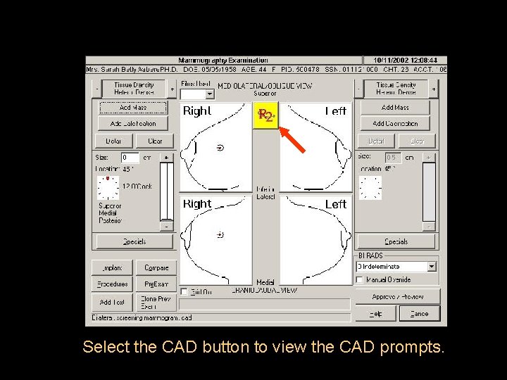 Select the CAD button to view the CAD prompts. 