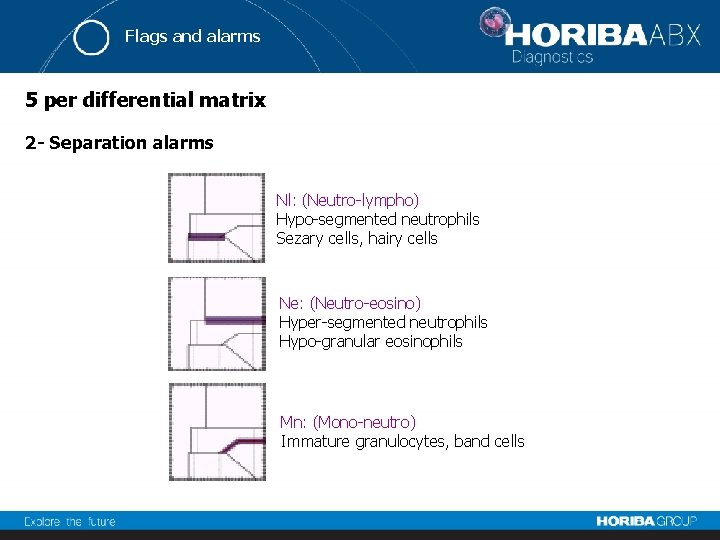 Flags and alarms 5 per differential matrix 2 - Separation alarms Nl: (Neutro-lympho) Hypo-segmented