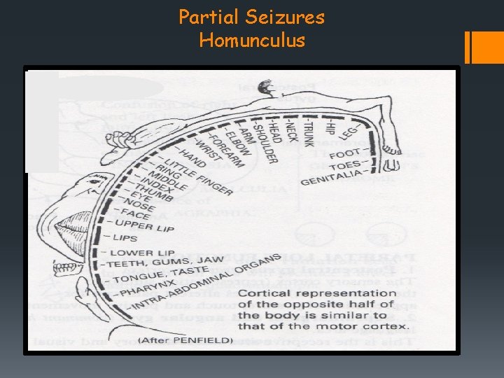 Partial Seizures Homunculus 