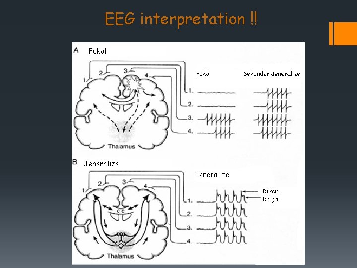 EEG interpretation !! 