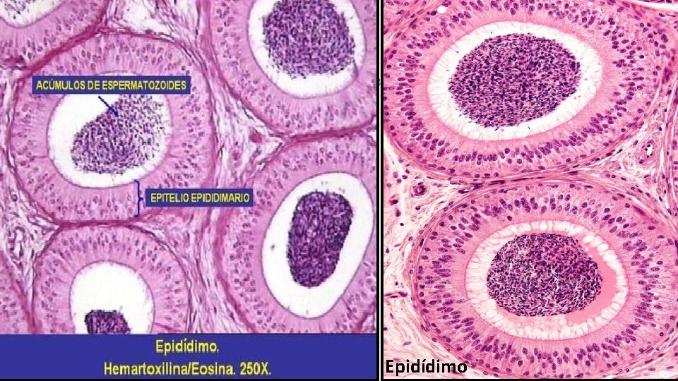 Epidídimo 