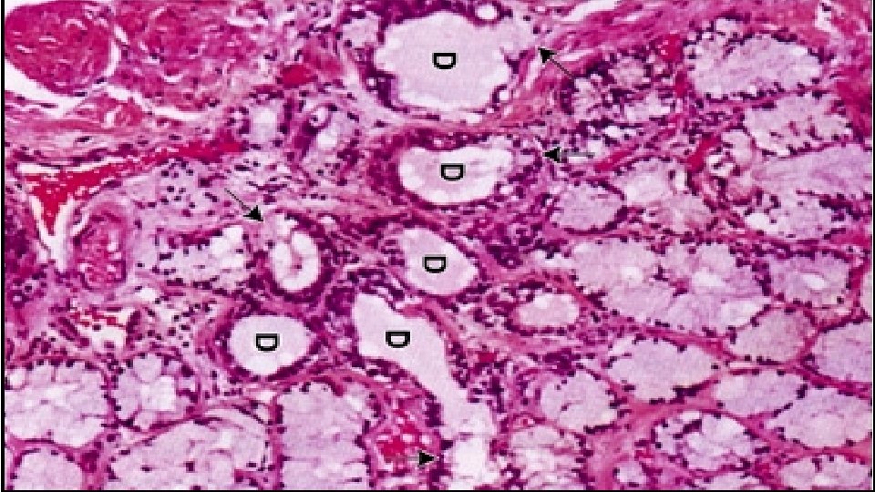 Glándula bulbouretral Son dos pequeñas glándulas ubicadas en la uretra membranosa, su secreción es