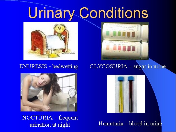 Urinary Conditions ENURESIS - bedwetting NOCTURIA – frequent urination at night GLYCOSURIA – sugar