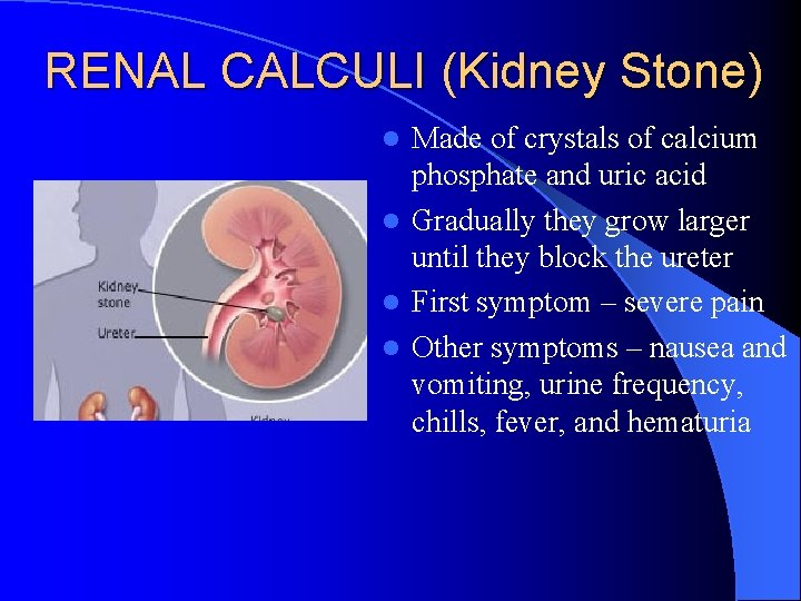 RENAL CALCULI (Kidney Stone) Made of crystals of calcium phosphate and uric acid l