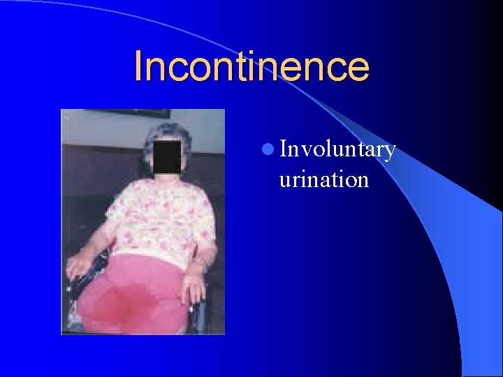 Incontinence l Involuntary urination Incontinence l Involuntary urination