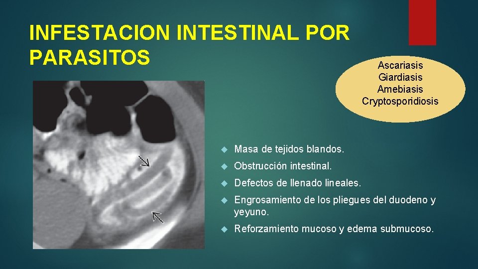 INFESTACION INTESTINAL POR PARASITOS Ascariasis Giardiasis Amebiasis Cryptosporidiosis Masa de tejidos blandos. Obstrucción intestinal.
