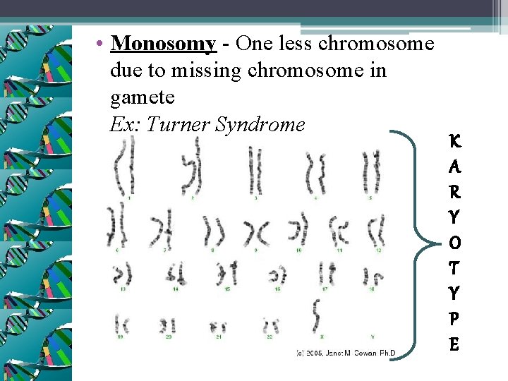  • Monosomy - One less chromosome due to missing chromosome in gamete Ex: