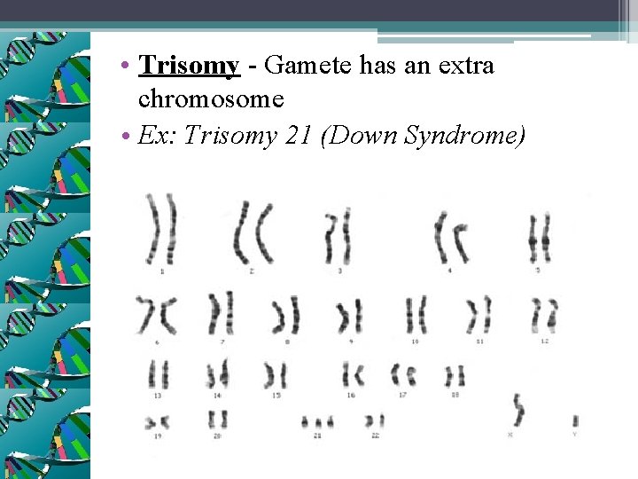 • Trisomy - Gamete has an extra chromosome • Ex: Trisomy 21 (Down