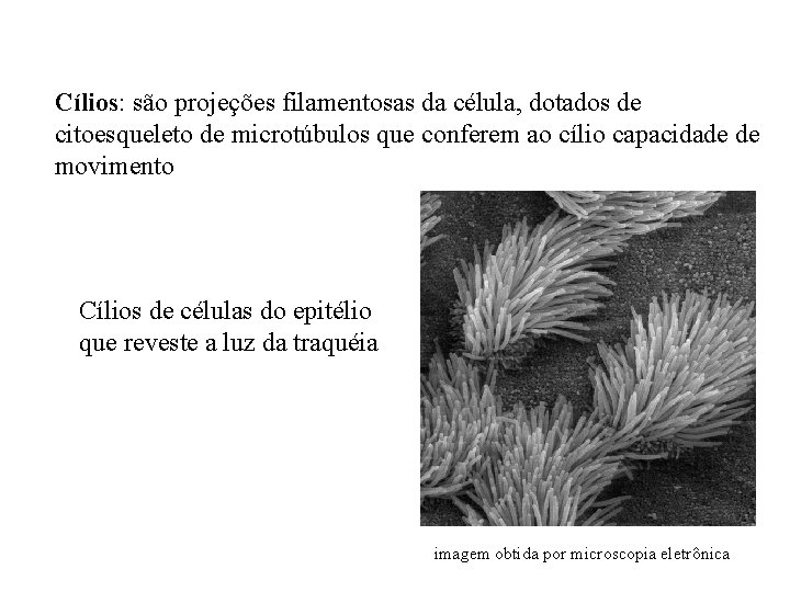 Cílios: são projeções filamentosas da célula, dotados de citoesqueleto de microtúbulos que conferem ao