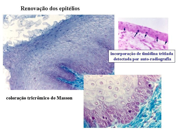 Renovação dos epitélios incorporação de timidina tritiada detectada por auto-radiografia coloração tricrômico de Masson