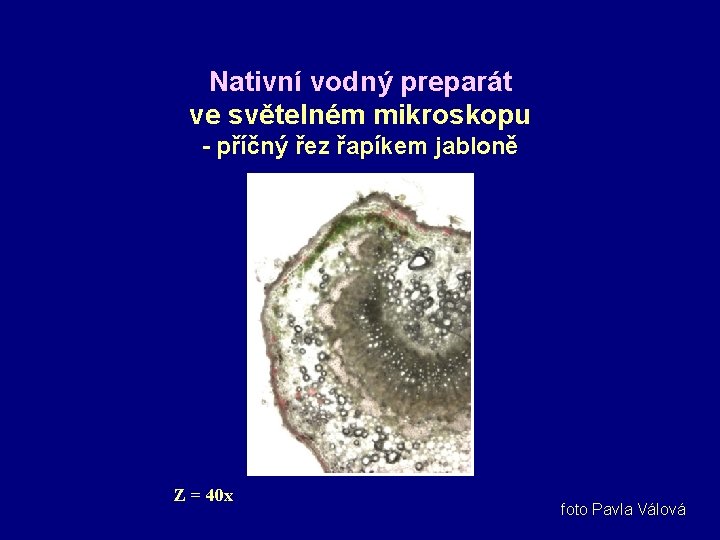 Nativní vodný preparát ve světelném mikroskopu - příčný řez řapíkem jabloně Z = 40
