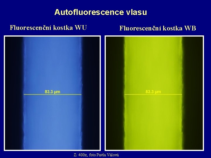 Autofluorescence vlasu Fluorescenční kostka WU Z: 400 x, foto Pavla Válová Fluorescenční kostka WB