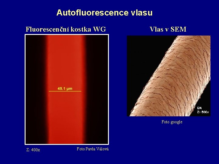 Autofluorescence vlasu Fluorescenční kostka WG Vlas v SEM Foto google Z: 400 x Foto