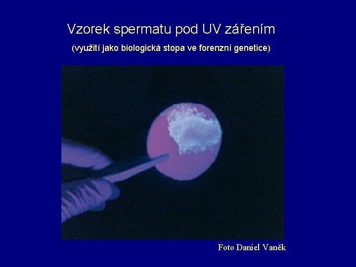 Vzorek spermatu pod UV zářením (využití jako biologická stopa ve forenzní genetice) Foto Daniel