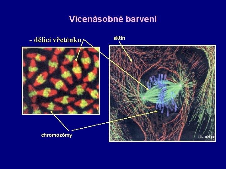 Vícenásobné barvení - dělicí vřeténko chromozómy aktin 