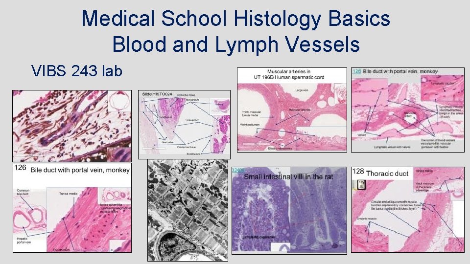 Medical School Histology Basics Blood and Lymph Vessels VIBS 243 lab 