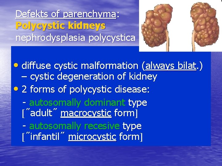 Defekts of parenchyma: Polycystic kidneys nephrodysplasia polycystica • diffuse cystic malformation (always bilat. )