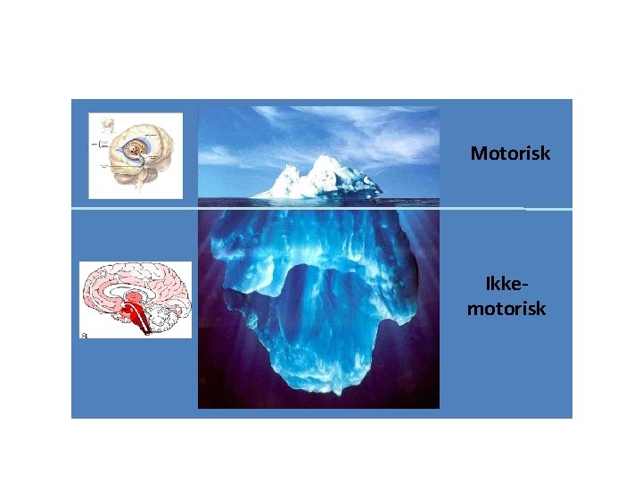 Motorisk Ikkemotorisk Motorisk Ikkemotorisk