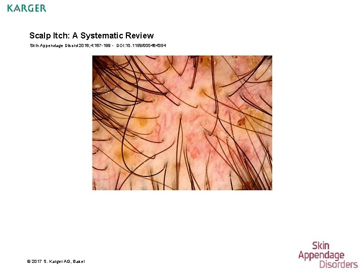 Scalp Itch: A Systematic Review Skin Appendage Disord 2018; 4: 187 -199 - DOI: