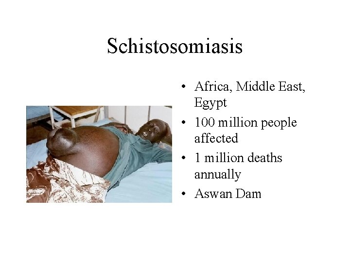 Schistosomiasis • Africa, Middle East, Egypt • 100 million people affected • 1 million