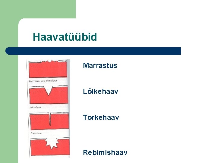 Haavatüübid Marrastus Lõikehaav Torkehaav Rebimishaav 