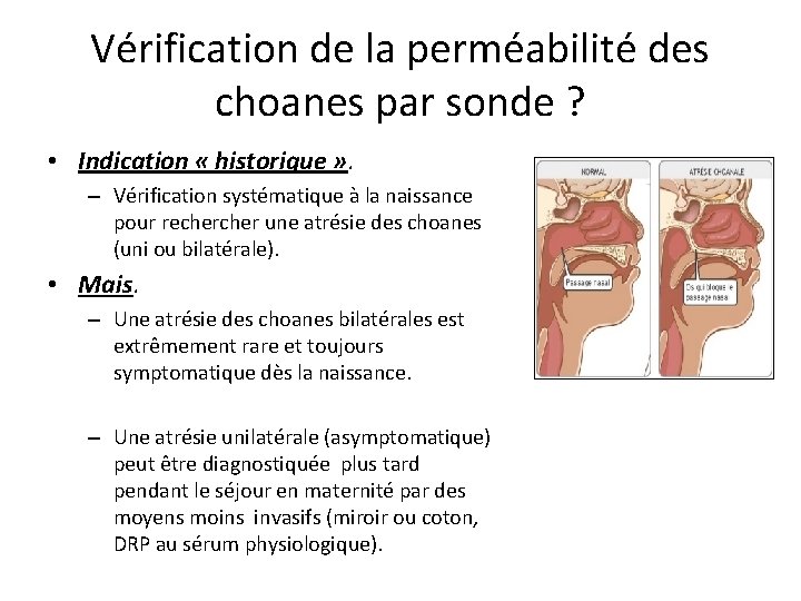 Vérification de la perméabilité des choanes par sonde ? • Indication « historique »