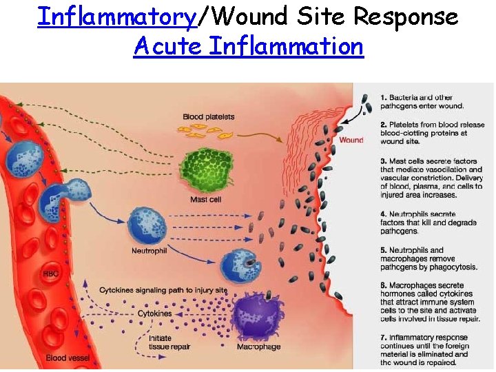 Inflammatory/Wound Site Response Acute Inflammation 