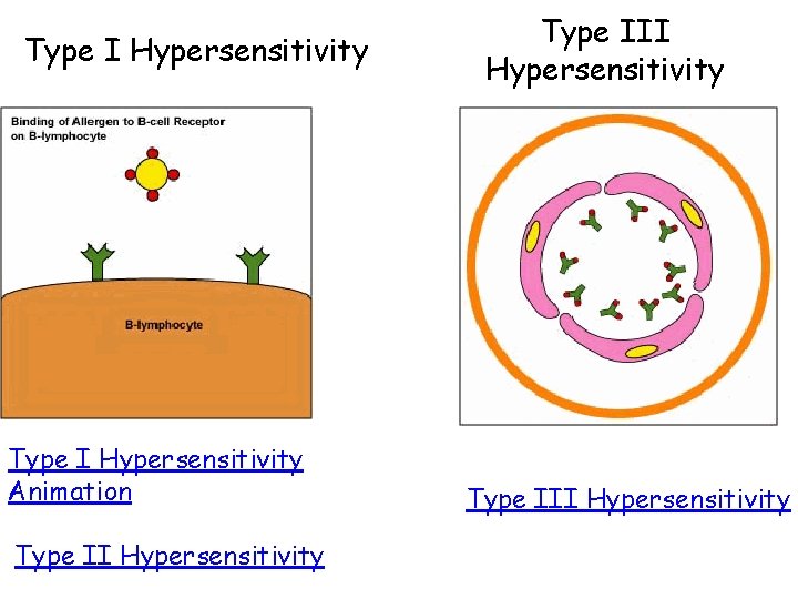 Type I Hypersensitivity Animation Type II Hypersensitivity Type III Hypersensitivity 
