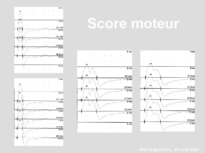 Score moteur Pitié-Salpêtrière, 20 avril 2007 