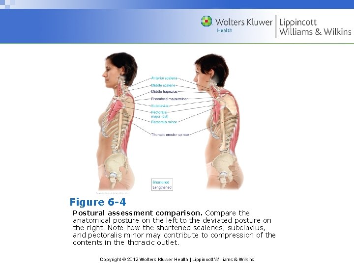 Figure 6 -4 Postural assessment comparison. Compare the anatomical posture on the left to