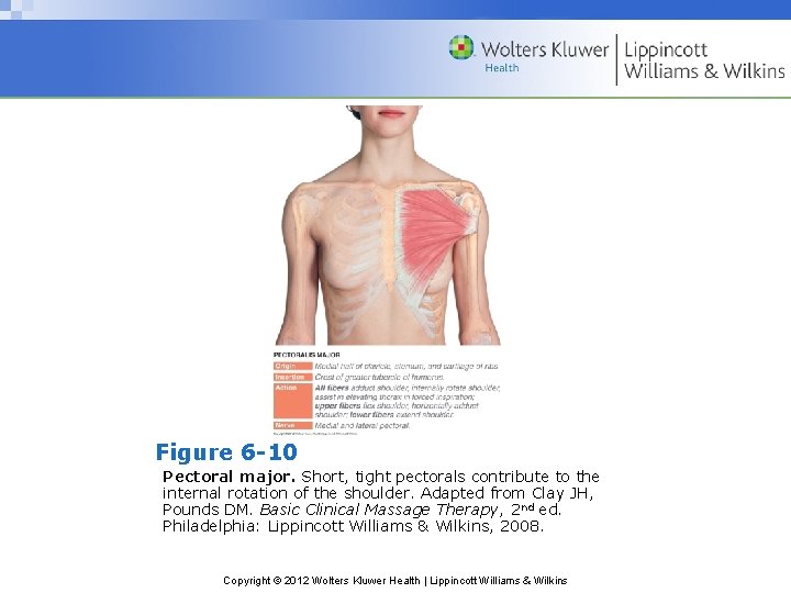 Figure 6 -10 Pectoral major. Short, tight pectorals contribute to the internal rotation of