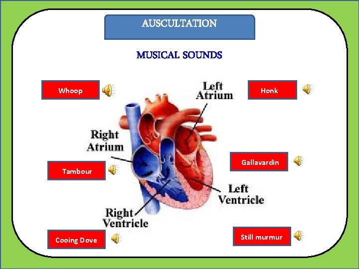 AUSCULTATION MUSICAL SOUNDS Whoop Tambour Cooing Dove Honk Gallavardin Still murmur 