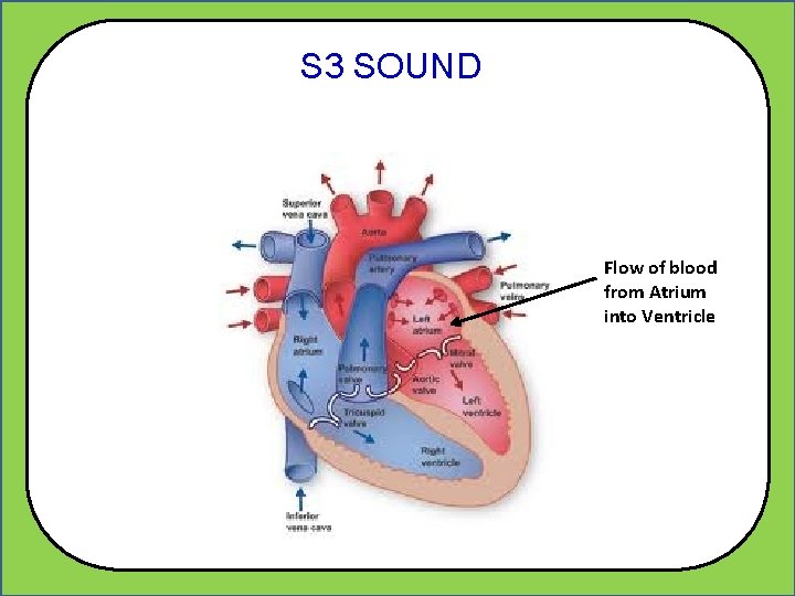 S 3 SOUND Flow of blood from Atrium into Ventricle 