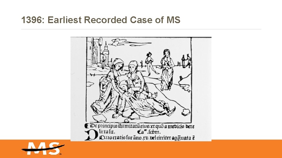 1396: Earliest Recorded Case of MS 